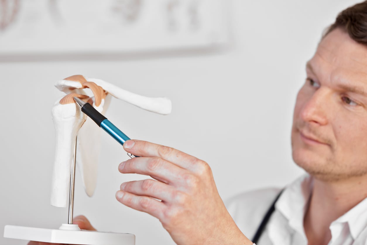 Impingement Syndrome