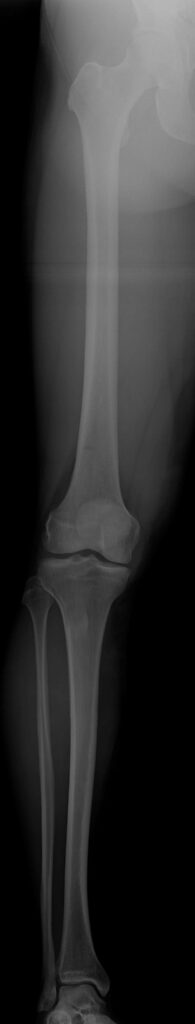 Achs-Korrektur Operateur Dr. Thomas Wieland